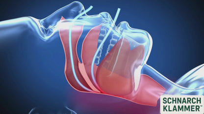 Schnarchklammer, Anti-Schnarchschiene